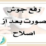 بهترین اسکین کر اصفهان رفع جوش صورت بعد از اصلاح