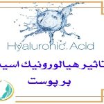 بهترین اسکین کر اصفهان | تاثیر هیالورونیک اسید بر پوست
