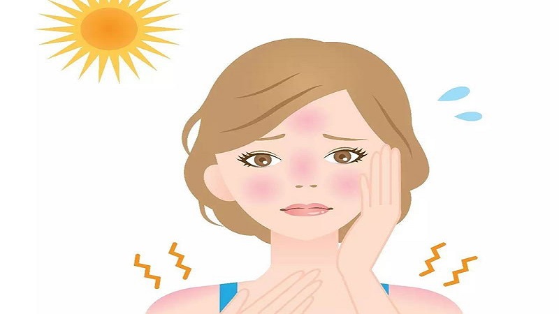 عوارض احتمالی آفتاب سوختگی | بهترین لیزر موی زاید اصفهان