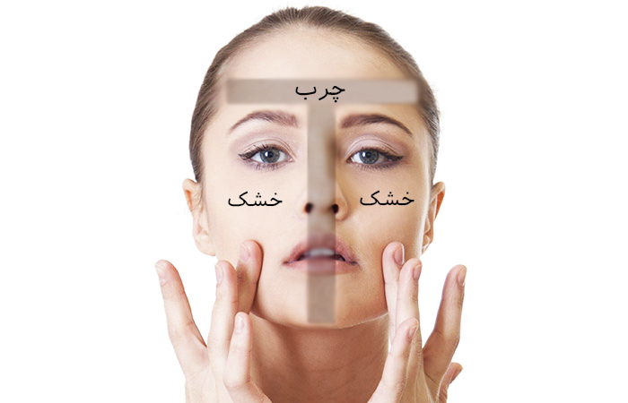 پوست مختلط چیست؟ | بهترین لیزر موی زاید اصفهان