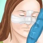 گذاشتن کمپرس یخ در اطراف بینی برای کاهش درد.